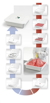 Optimierter Arbeitsablauf mit dem ARES System